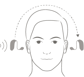 Line drawing of a head wearing a small device on each ear, with a dashed arc over the head showing sound picked up at the poorer ear being routed across to the better-hearing ear